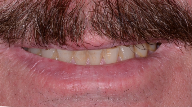 Before
